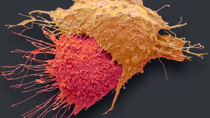 Cancer