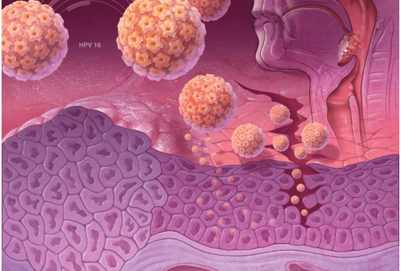 Head-Neck-HPV