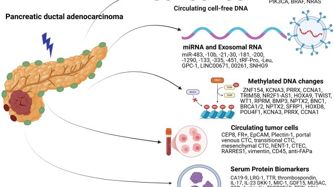 Pancreatic-Cancer-2