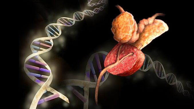 Prostate-Cancer-DNA