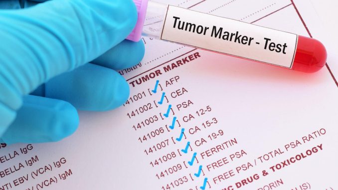 Tumor-Marker-Test